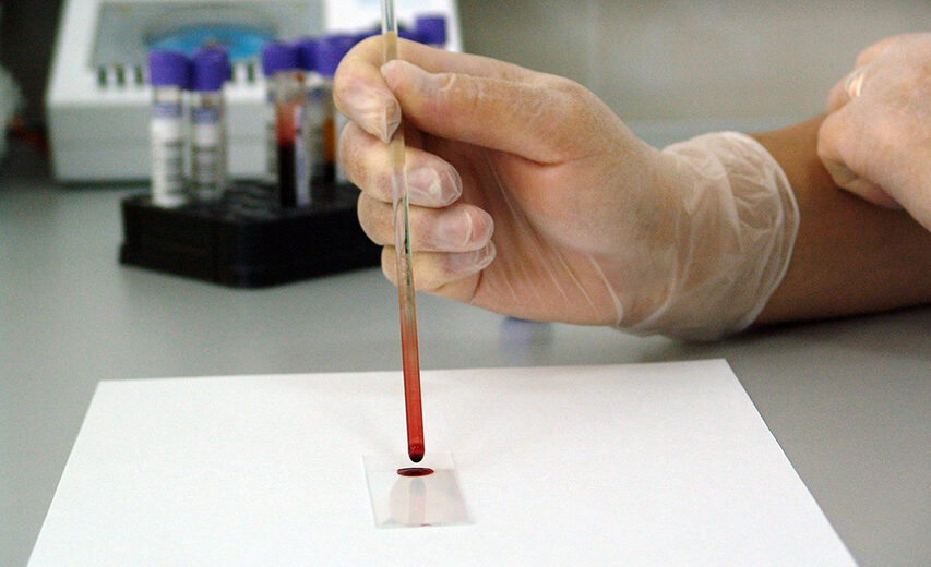 Nauji klinikinių tyrimų tikslai Europoje