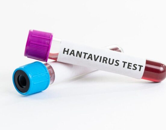 Trys žuvo dėl įtariamo hantaviruso protrūkio kruiziniame laive